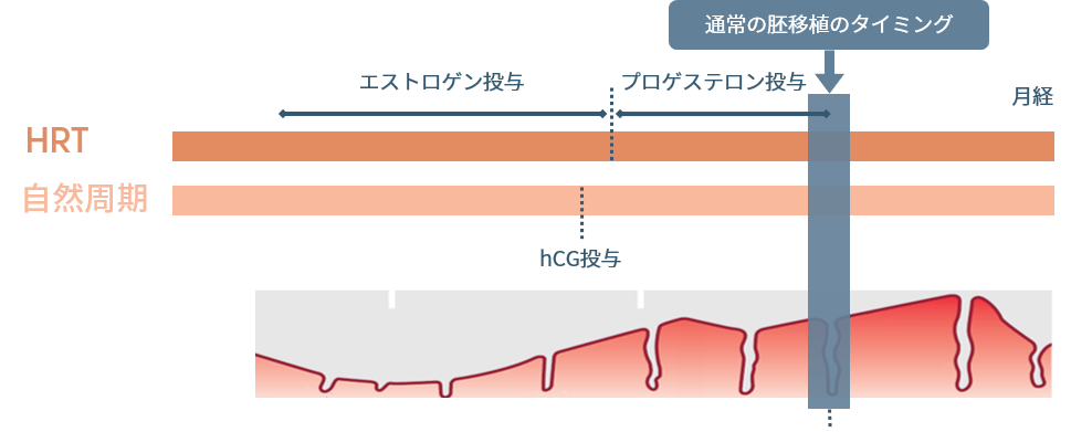 ERA検査のタイミング